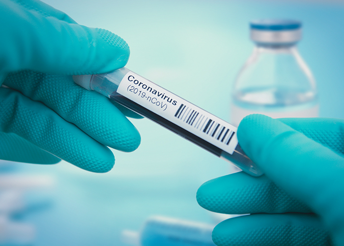 coronavirus test.jpg