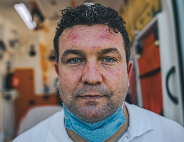 bruising 1.jpg