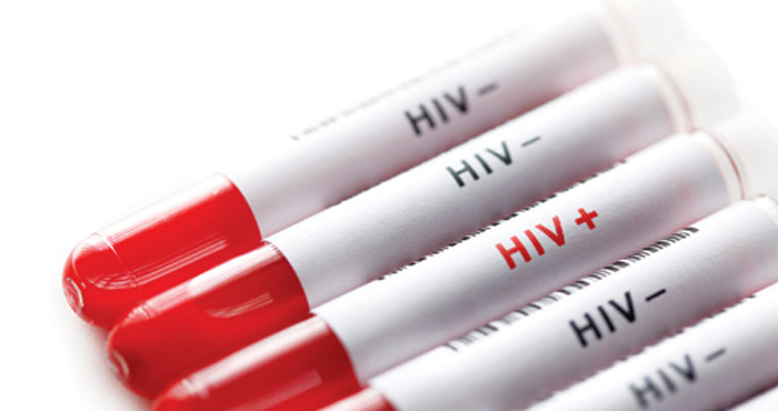 HIV blood vials.jpg