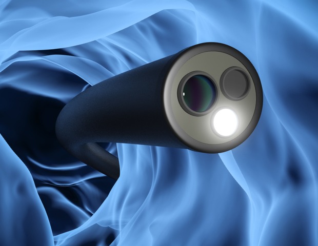 colonoscopy-concept-id1174712990b.jpg
