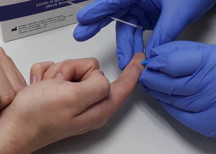 covid-19 antibody testing Jersey coronavirus.jpg