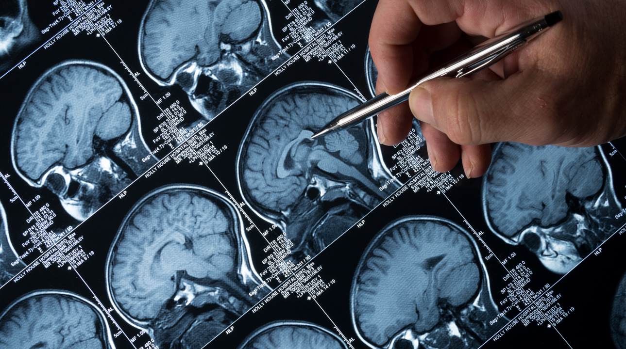 brain scan.jpg