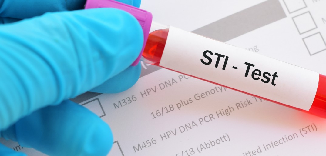 STI tests 1075.jpg