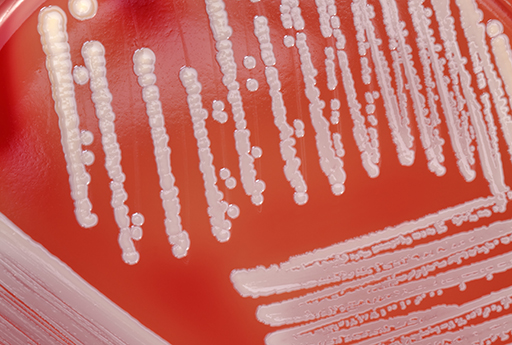 antibiotic resistance_bugs_petri dish.jpg